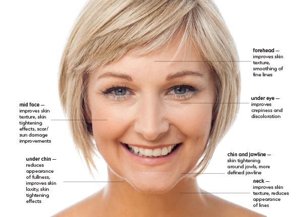 womans face noting procedure areas
