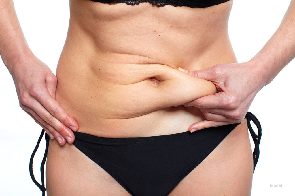 Do I Need a Tummy Tuck or Liposuction? - Philadelphia, PA - Dr