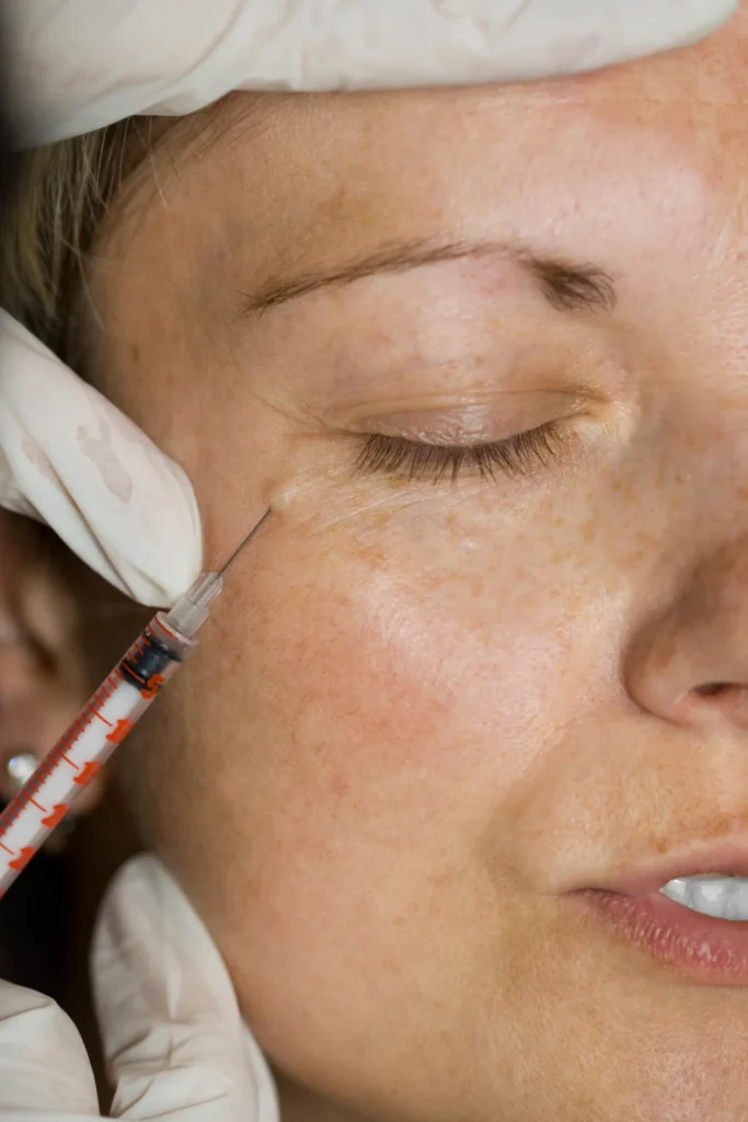 art of injectables