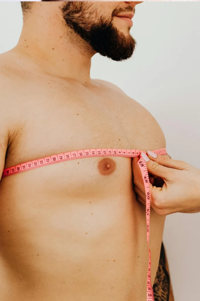 gynecomastia recurrence after surgery