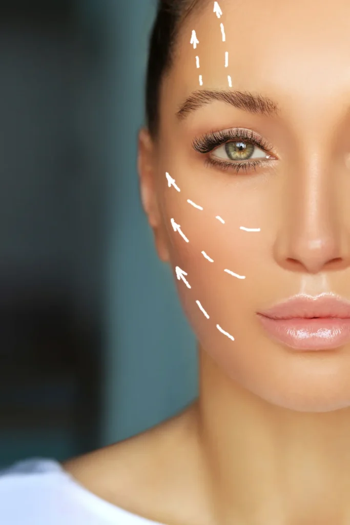 male vs female facelift