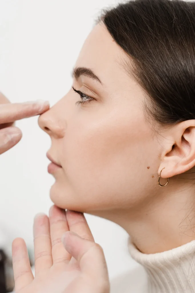 rhinoplasty recovery time