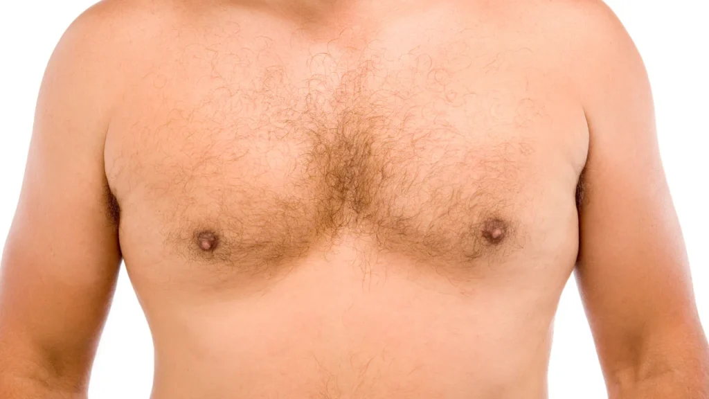 Skin-sparing mastectomy