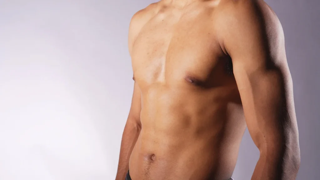 Subcutaneous Mastectomy