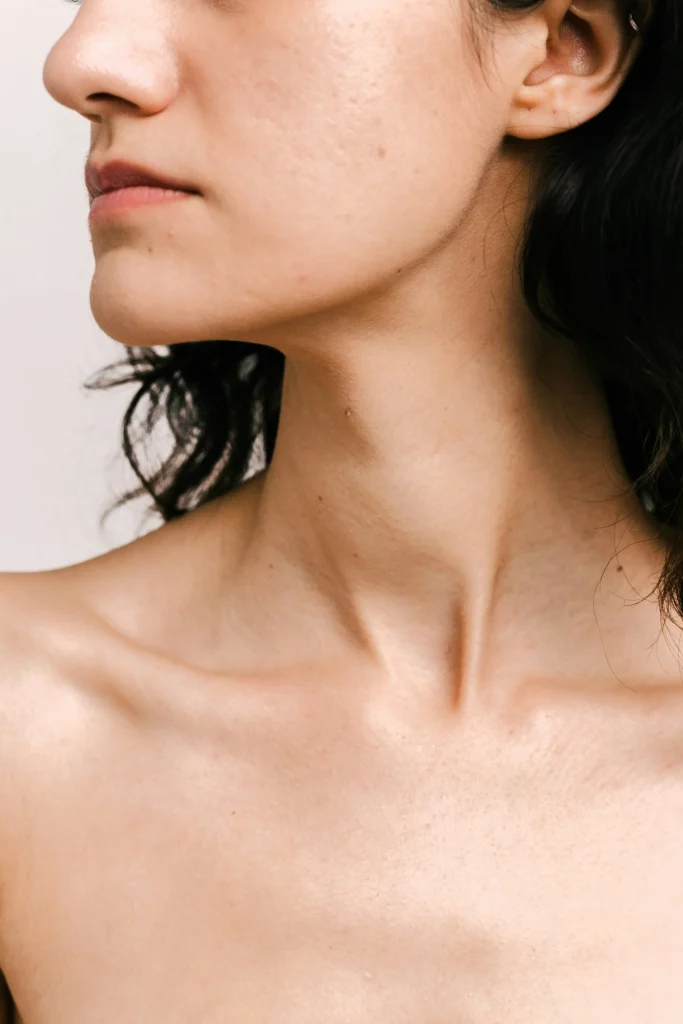 woman with Nefertiti Neck Lift