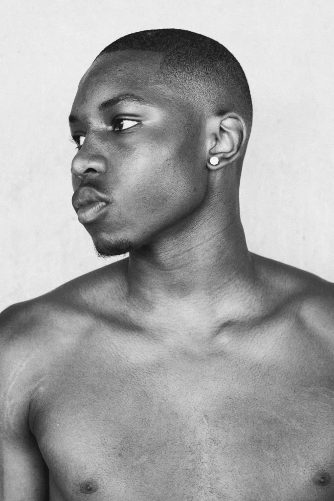 Man with Nefertiti Neck Lift