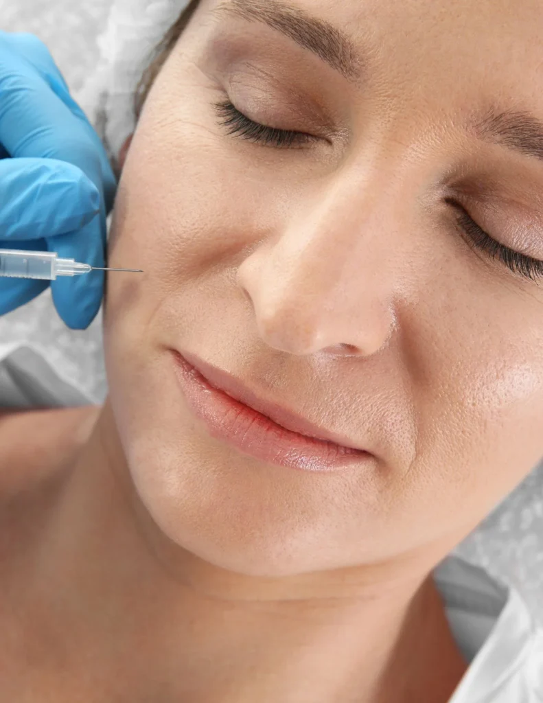 best dermal filler for nasolabial folds