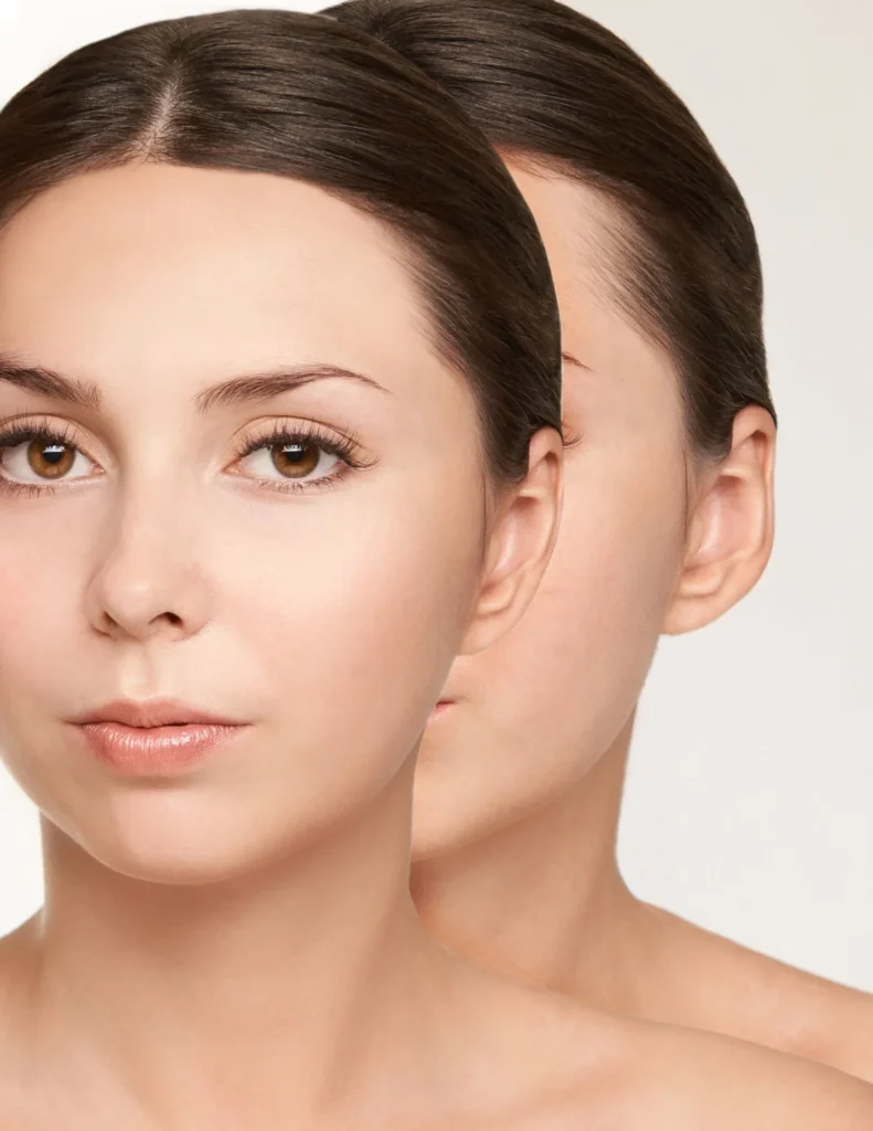 woman with otoplasty recovery