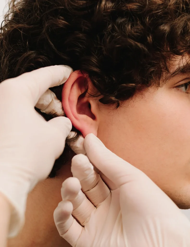 otoplasty recovery