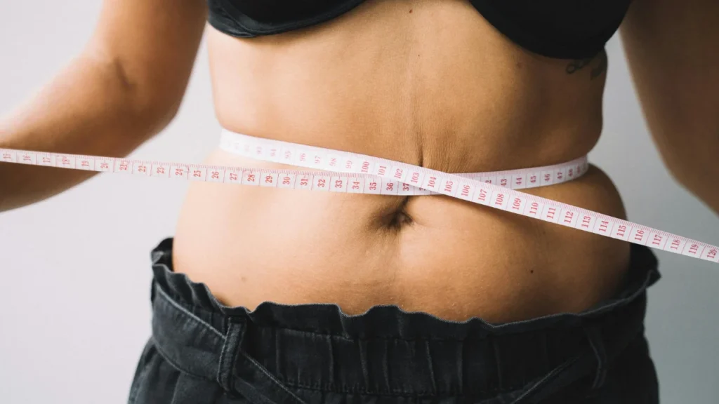 tummy tuck after pregnancy