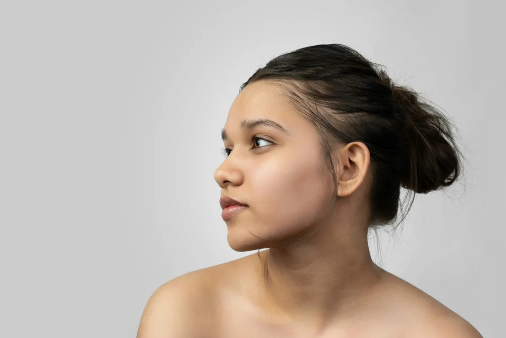 rhinoplasty swelling stages​