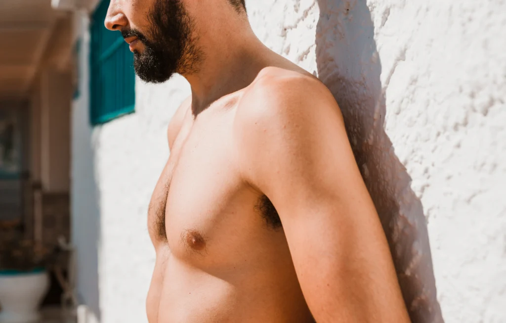 gynecomastia vs chest fat
