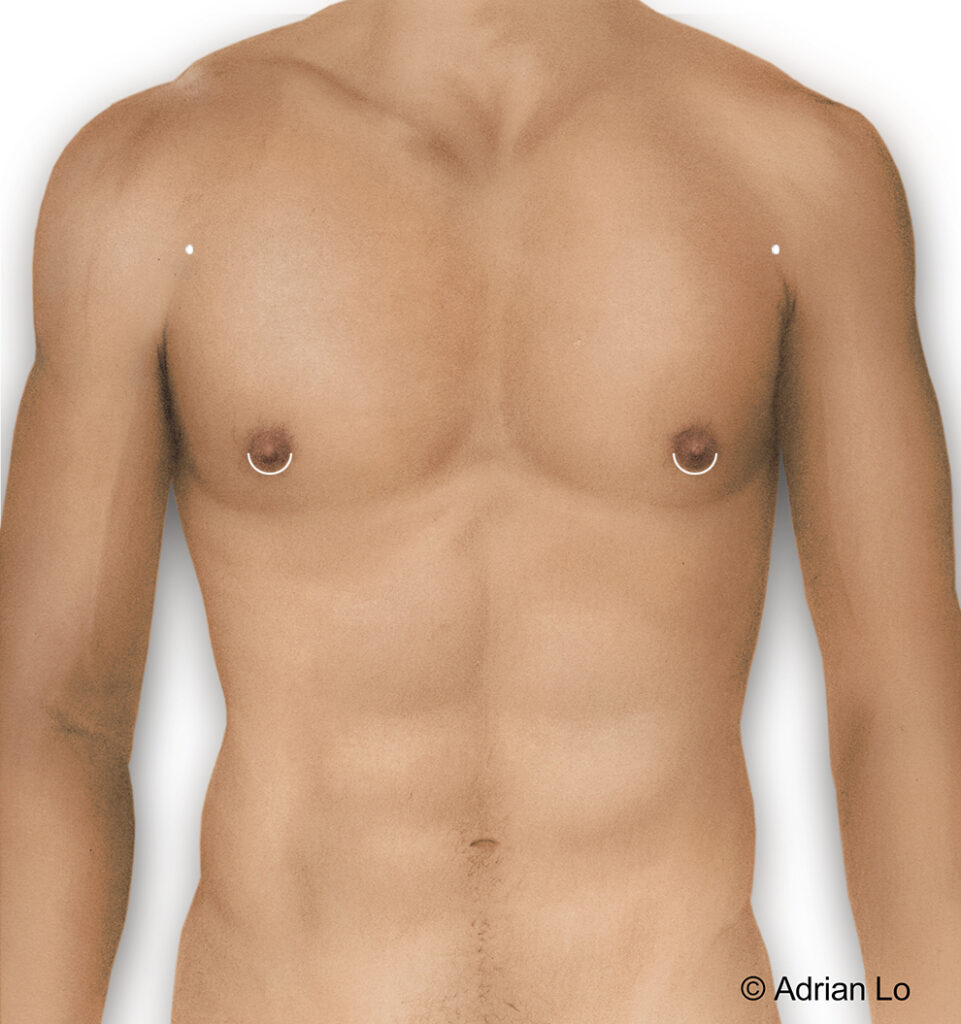 male chest with scar lines