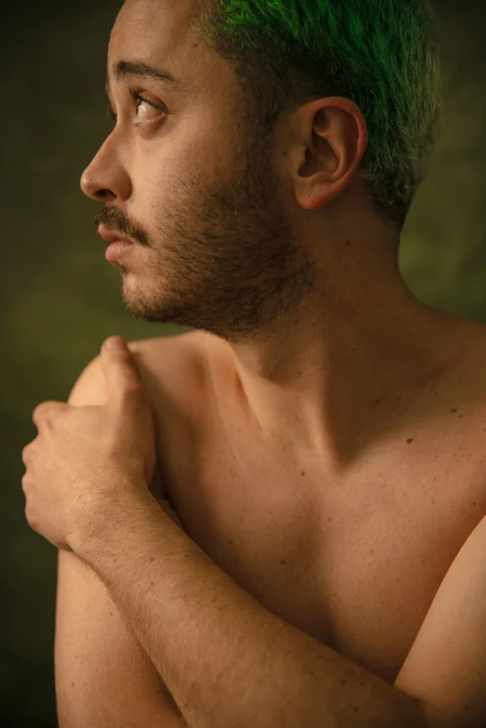 severe gynecomastia