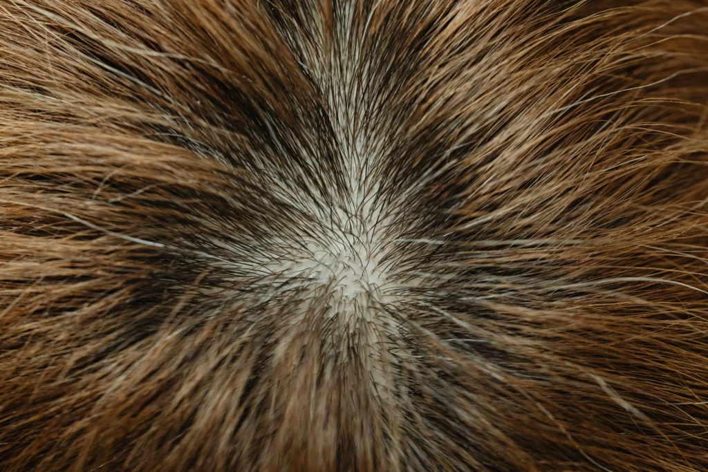 Image of a close-up view of hair strands radiating from a scalp center showing natural hair growth patterns