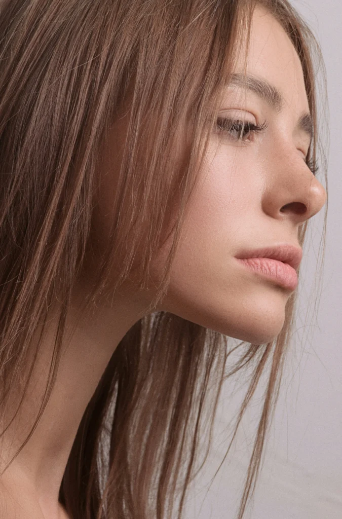 Image of nose results after bulbous tip rhinoplasty surgery​