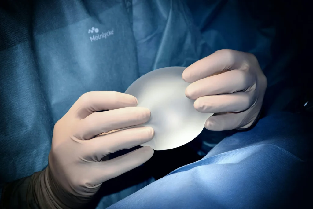 Image of a surgeon holding a silicone breast implant demonstrating benefits of motiva breast implants