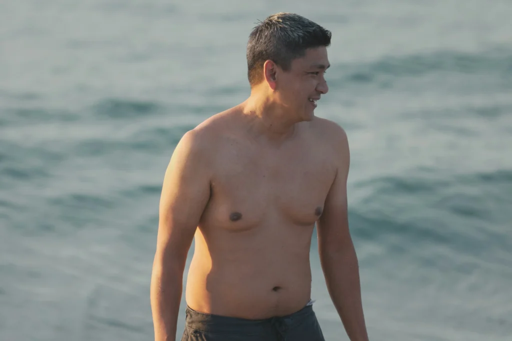 image of man with mild gynecomastia standing shirtless on a beach