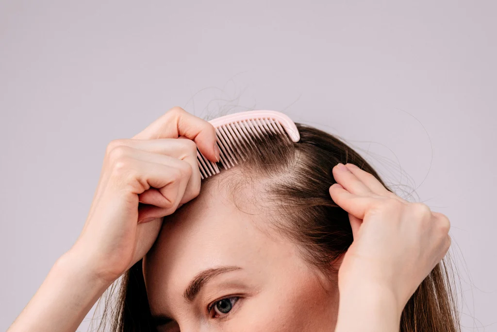 Image of woman parting hair with comb to check for scalp thinning