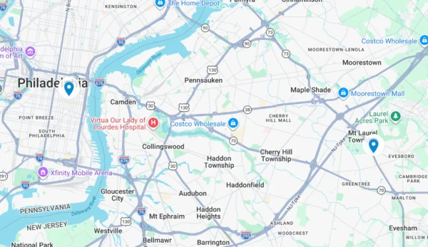 map of Dr. Adrian Lo's service area in Cherry Hil and Philadelphia for ARTAS hair transplant