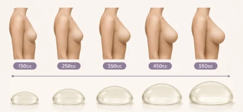 image of breast implant sizes from 150cc to 550cc side profile comparison
