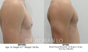 For Men Before and After Patient Thumbnail 3